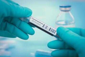 PI é o segundo Estado em realização de testes de coronavírus