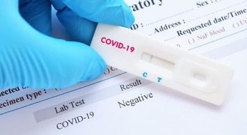 Piauí utiliza teste de qualidade para identificação do coronavírus